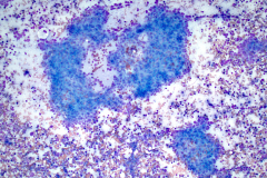 Diff-Quik stain 10x 10x