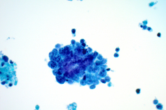 ThinPrep® Non-Gyn 40x