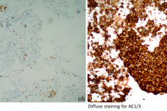 P40 10x and AE1/3 20x
