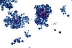 rhabo-thinprep-40x-2