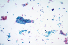 ThinPrep Pap test 10x