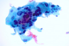 ThinPrep Pap test 40x