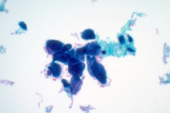 ThinPrep Pap test 60x