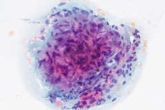 Smear, Modified Romanowsky, 20x
