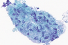 ThinPrep® Non-Gyn 40x