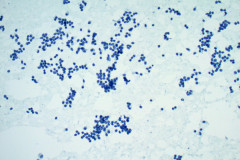 Smear-Pap-Stain-20x-1