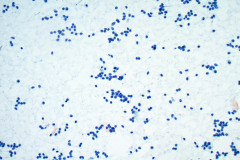 Smear-Pap-Stain-20x-2