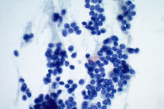 Smear-Pap-Stain-60x