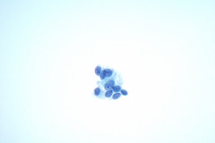 ThinPrep-Non-Gyn-slide-60x-1