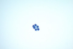 ThinPrep-Non-Gyn-slide-60x-2