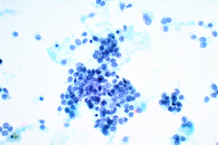 ThinPrep® Non-Gyn 40x