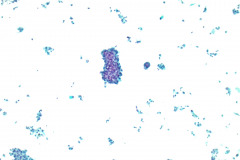 ThinPrep® Non-Gyn 10x
