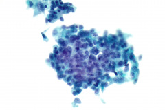 ThinPrep® Non-Gyn 40x