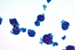 ThinPrep® Non-Gyn 20x