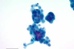 ThinPrep® Non-Gyn 40x