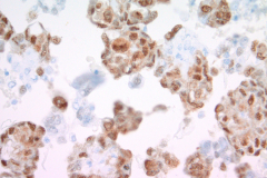 Traditional cell block CAMTA 40x