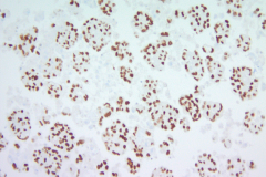 Traditional cell block ERG3 20x