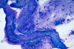 Modified Romanowsky Smear, 20x