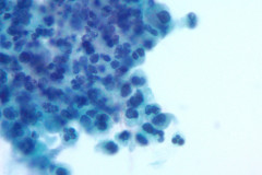 nocardia-thinprep-oil-immersion-1000x