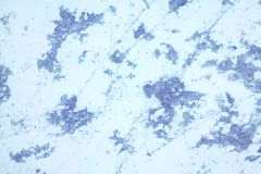 AbundantCellularity_4x_40mag_ThinPrep