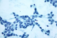 HoleMimicInNuclei_40x_400mag_ThinPrep